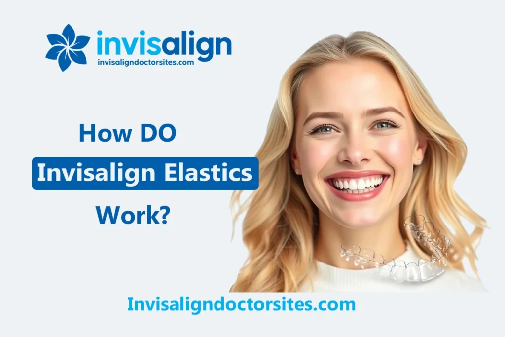 Invisalign Elastics